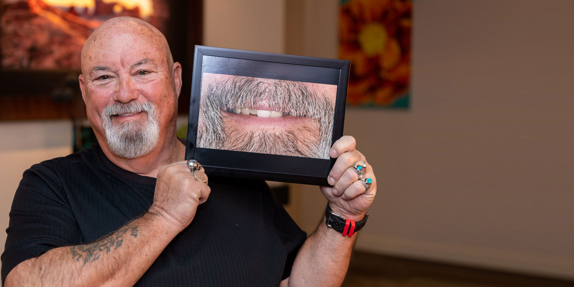 dental crowns and bridges patient smiling