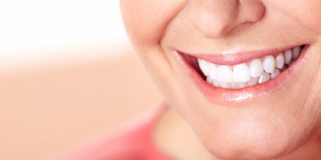 dental implants patient smiling