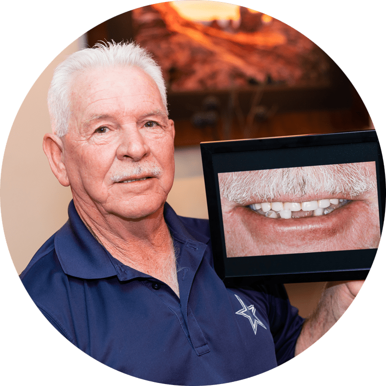implant supported dentures patient
