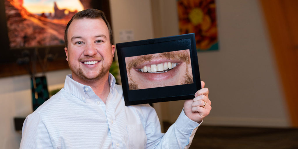 porcelain veneers patient smiling