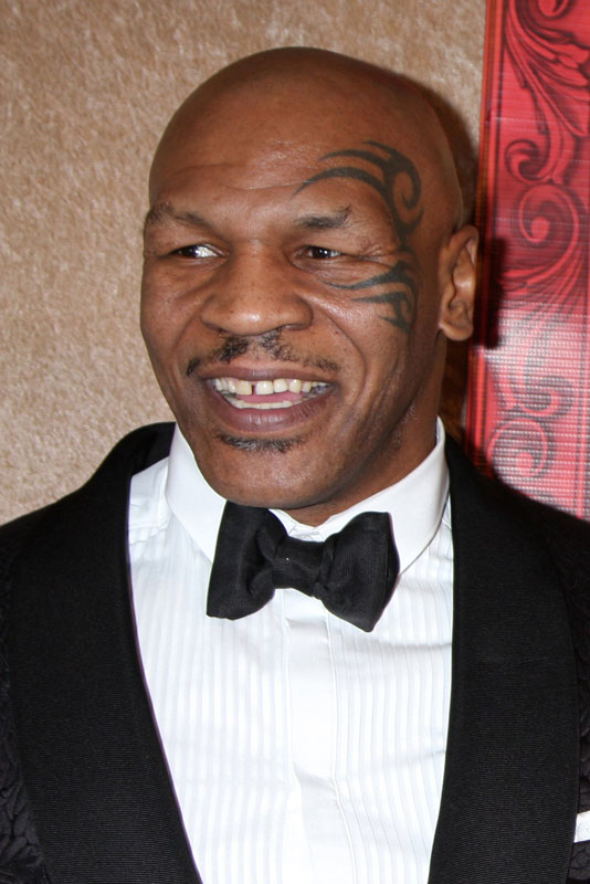 Mike Tyson Smiling After Getting His Dental Implant Surgery