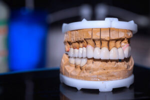 Close up photo of a professional mouth prosthesis model